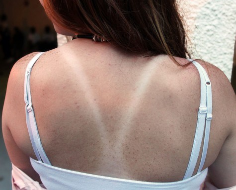 Swimmer Michelle Murray is in the sun daily, with notice effects of the sun's UV rays.